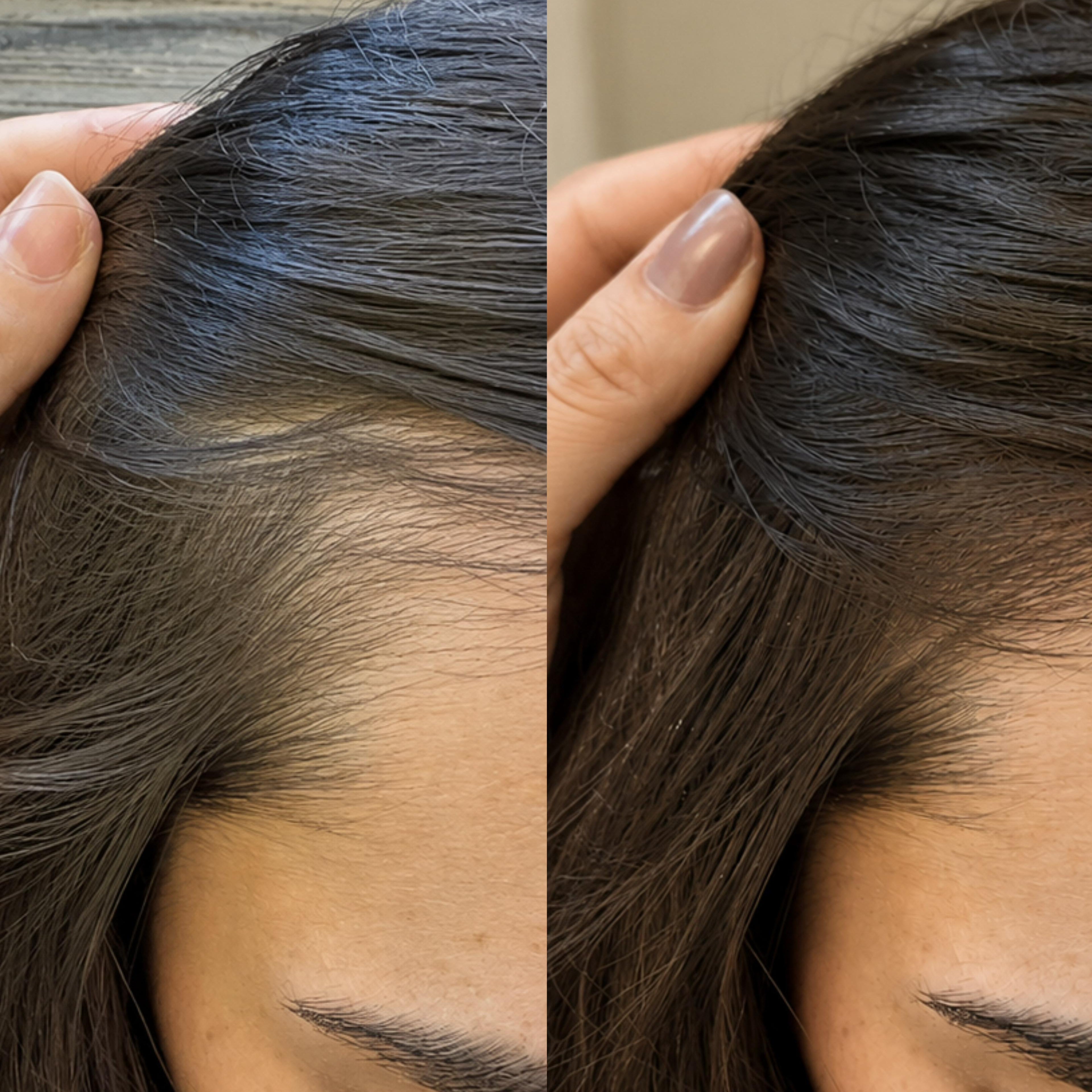 Hairline & Scalp Growth Mask